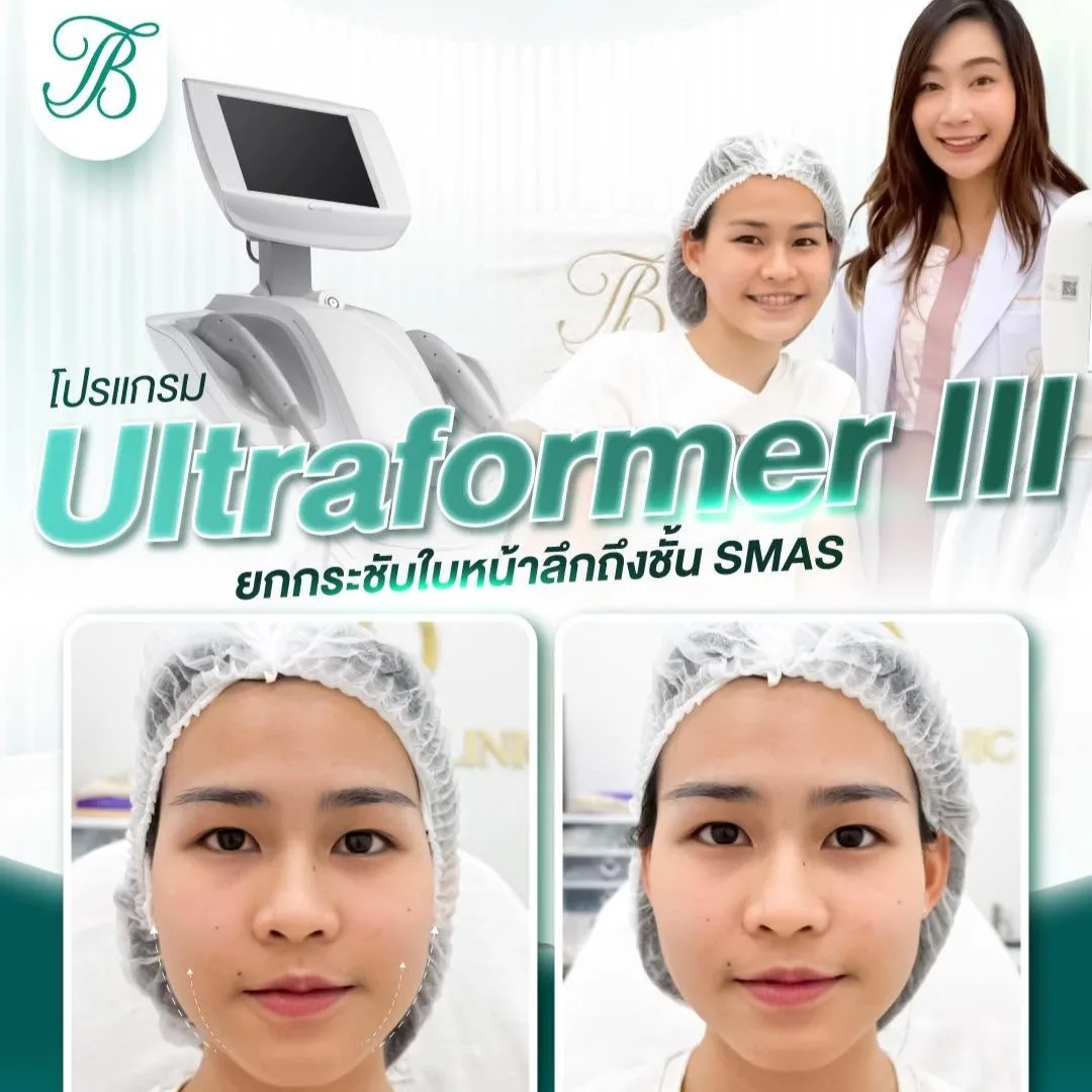 ภาพประกอบบริการ Ultraformer III จาก Dr.Bitoei Clinic